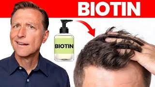 Does Biotin or Biotin Shampoo Really Work for Hair Loss [upl. by Ayalat]