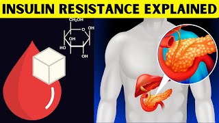 Insulin Resistance Explained What Is Insulin Resistance amp How It Leads To Type II Diabetes [upl. by Strepphon]