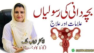 What is Uterine Fibroid in Urdu  Uterine fibroids explained by Dr Zainab Malik [upl. by Idnib]