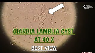 Giardia Lamblia cyst view at 40 XBest microscopic view of giardia cystgiardia parasite in stool [upl. by Annayek]