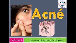 Quel Meilleur Traitement Pour l’Acné sévère du visage Méthode Laser Hormonale Naturel Antibiotique [upl. by Anined]