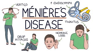 Understanding Ménière’s Disease [upl. by Naujej563]