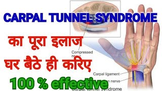 CARPAL TUNNEL SYNDROME TREATMENT Complete Cure  100  Effective Treatment Of CTS [upl. by Assirehc]