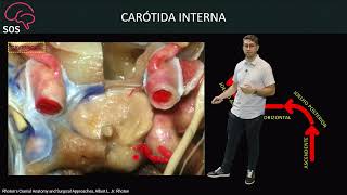 Vascular  Anatomia e Aneurismas da Carótida Interna e Cerebral Posterior [upl. by Sidoma]