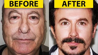 INSANE Plastic Surgery Results  Real or FAKE [upl. by Bekaj369]