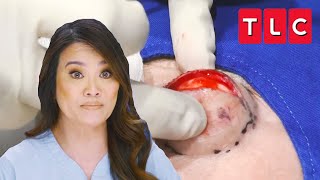 Dr Lee Examines James quotEyePopping Bumpsquot  Dr Pimple Popper [upl. by Dyanne]