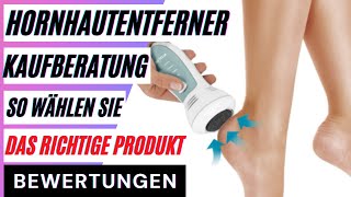 Hornhautentferner Kaufberatung So wählen Sie das richtige Produkt aus dem Hornhautentferner Test [upl. by Milo207]