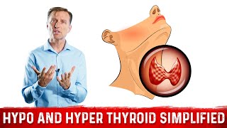 Hyperthyroid vs Hypothyroid Explained By Dr Berg [upl. by Efram]