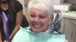 Houston Cosmetic DentistHow to fix a Crooked Smile Affordably [upl. by Nede]