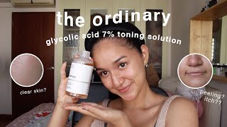 the ordinary glycolic acid toner 1 MONTH review w BEFOREAFTER [upl. by Kieran449]