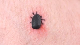 DEADLIEST TICK EVER [upl. by Brion]