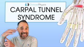 Carpal Tunnel Syndrome  Expert Physio Overview with Diagnosis Tips and Exercises [upl. by Kinney408]