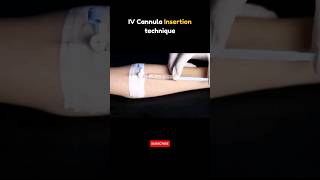 IV Cannula Insertion Technique 💉 iv ivy cannula cannulation [upl. by Convery]