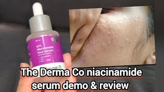 The Derma Co niacinamide serum demo amp review  how to use niacinamide serum rRmivlogs53 [upl. by Earehs]