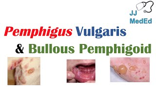 Vesiculobullous Skin Diseases  Pemphigus Vulgaris vs Bullous Pemphigoid [upl. by Sirkin447]