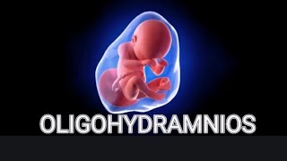 Oligohydramnios in Urdu  پانی کی کمی  Low AFI ultrasound  Pregnancy men baby water ki kami [upl. by Lleuqram662]