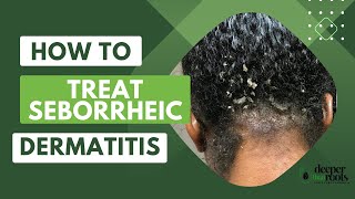 How to treat Seborrheic Dermatitis deeperthanrootsscalpcare [upl. by Roberto]