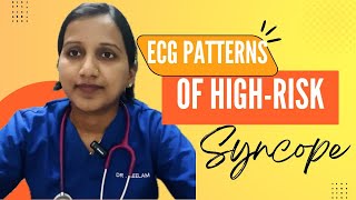 ECG Patterns of HighRisk Syncope [upl. by Leela855]