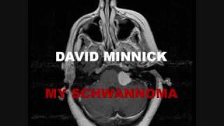 My Schwannoma  David Minnick Version [upl. by Madriene]