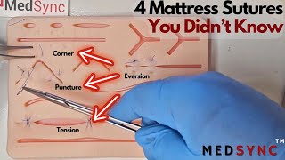 You Dont Know All 4 Mattress Sutures BUT YOU NEED TO [upl. by Novj868]