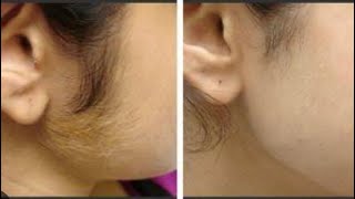 Rica wax tutorial  face wax Rica wax use for face hair remove [upl. by Mallory]