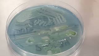 Lactose fermenting colonies of Raoultella ornithinolytica became Nonlactose fermenting after old [upl. by Leakim]