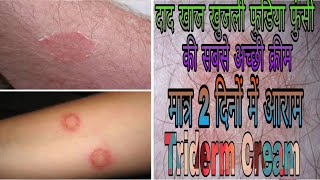 Triderm cream in hindi [upl. by Ynabe]