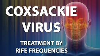 Coxsackie Virus  RIFE Frequencies Treatment  Energy amp Quantum Medicine with Bioresonance [upl. by Ecissej]