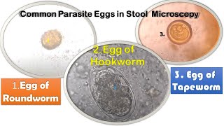 Roundworm Tapeworm and Hookworm eggs in Stool Microscopy [upl. by Magree222]