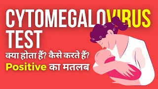 Cytomegalovirus IgG Test in Hindi  CMV IgG Test Positive क्या होता है [upl. by Allesor722]