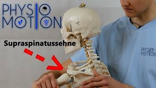 Verletzungen der Supraspinatussehne PhysioampMotion 2 [upl. by Hpsoj]