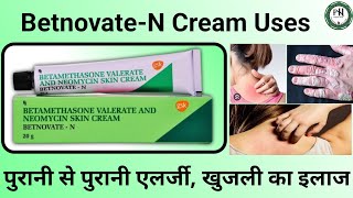 BetnovateN Cream Uses in Hindi  BetnovateN benefits  Skin infection  Psoriasis  Eczema [upl. by Nelak]