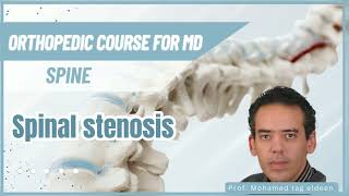 Spinal stenosis  spine Orthopedic course كورس عظام ماجستير ودكتوراه د محمد تاج الدين [upl. by Ahsinyt]