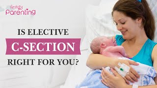 Should You Have an Elective CSection [upl. by Nonaihr602]