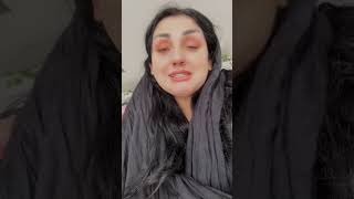 Foreign accent syndrome سیندرۆمی ئەکسێنتی بێگانە 🤨🤨🤨foreignaccentsyndrom [upl. by Alia]