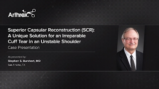 Superior Capsular Reconstruction SCR A Unique Solution for an Irreparable Cuff Tear [upl. by Dyoll]