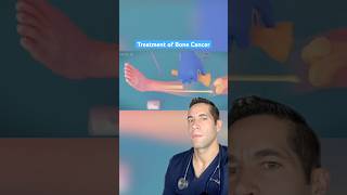 Doctor Reacts bone cancer treatment [upl. by Redvers]