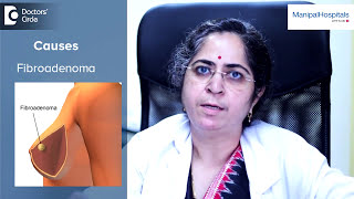 Cancerous Breast Lumps  Breast Lumps Treatment  Dr Poonam Patil  Oncology  Manipal Hospitals [upl. by Albemarle638]