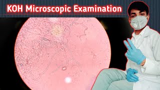 KOH Microscopic Examination  Septate Hyphae fungi  septate and aseptate Hyphae  fungal stain [upl. by Saiff]