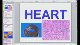 Medical School Pathology 2012 Session 041 Heart Imp4 [upl. by Iila]