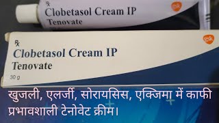 एक्जिमासोरायसिस एलर्जी जिंलद वाली खुजली। Tenovate Cream gsk use in allergypsoriasis eczema [upl. by Ttezil249]