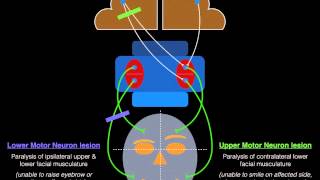 Facial Palsy Upper and Lower Motor Neuron Lesions  Dr MDM [upl. by Peony]