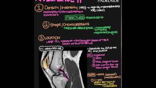 Radiographic Appearance Explain Everything Video [upl. by Goldsworthy]