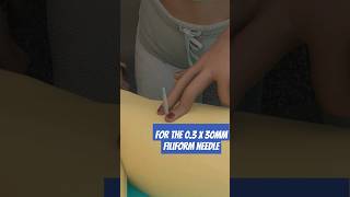 How to dry needle the fibularis longus [upl. by Elvis244]