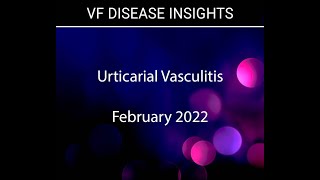 Urticarial Vasculitis Overview [upl. by Britteny42]