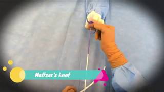 Laparoscopic Meltzers Knot [upl. by Anitrak]