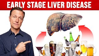 How Much Alcohol Would You Have to Drink Before Liver Damage [upl. by Northington]