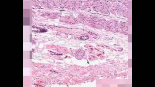 Shotgun Histology GastroEsophageal Junction [upl. by Mehta]