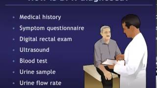 Understanding Benign Prostatic Hyperplasia BPH [upl. by Mozes]