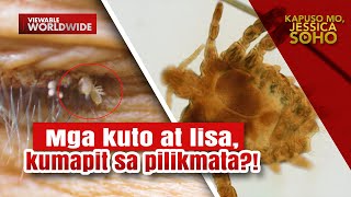 Mga kuto at lisa kumapit na rin sa pilikmata ng isang pamilya sa Quezon  Kapuso Mo Jessica Soho [upl. by Sackville180]